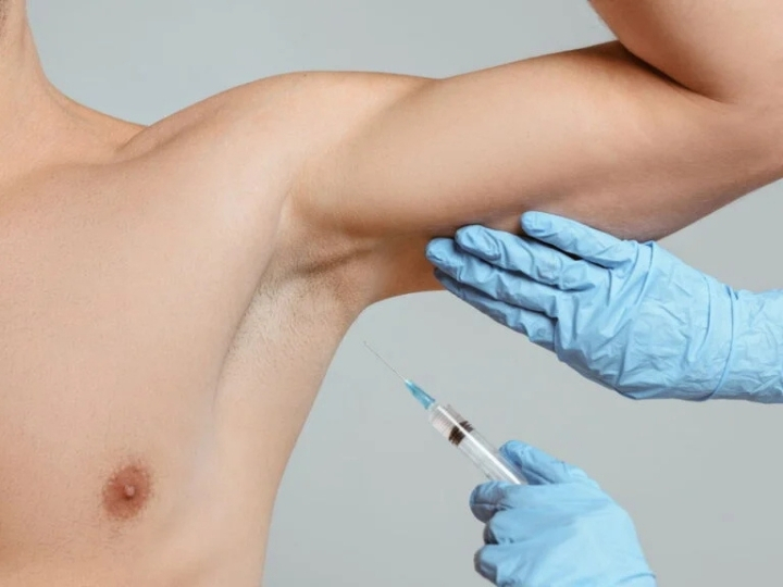 Profissional aplicando botox corporal nas axilas de paciente na Ollige Clinic