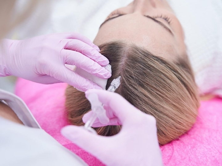 Profissional aplicando enzimas capilares no couro cabeludo de um paciente na Ollige Clinic