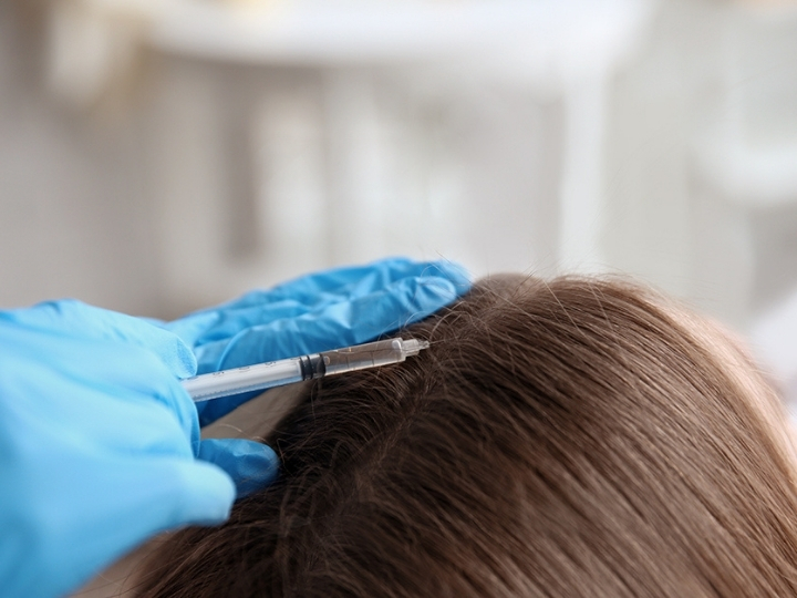 Profissional aplicando enzimas capilares no couro cabeludo de paciente na Ollige Clinic