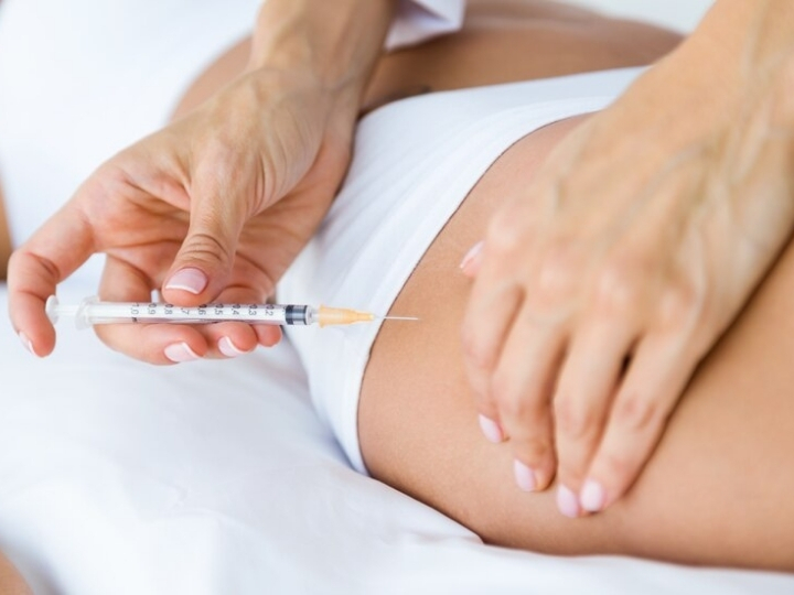 Resultado de harmonização corporal com preenchimento na região dos glúteos na Ollige Clinic