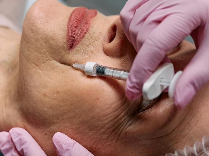 Resultado da harmonização facial de paciente na Ollige Clinic
