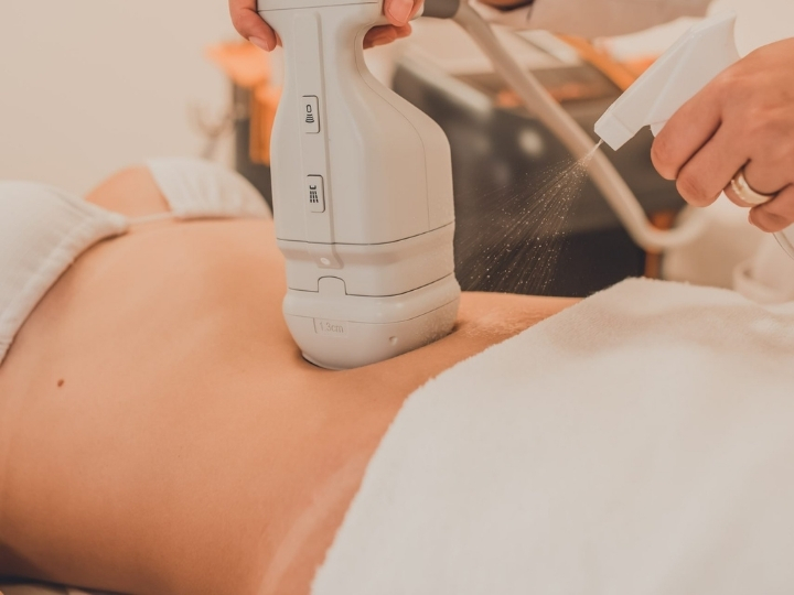 Aplicação de hipro ultrassom microfocado corporal na Ollige Clinic