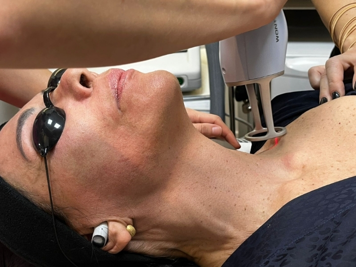 Profissional realizando tratamento de Laser Lavieen Corporal em paciente na Avenida Paulista com tecnologia avançada para firmeza e renovação da pele
