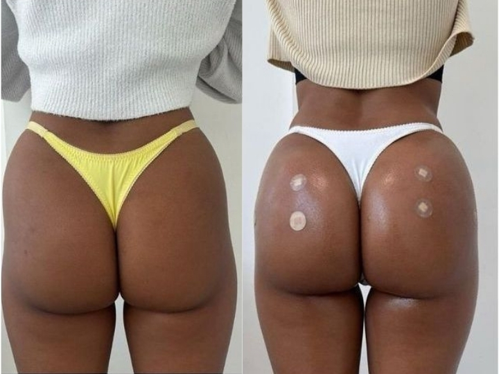 Imagem comparativa do antes e depois de harmonização corporal com melhora do contorno e firmeza da pele na Avenida Paulista